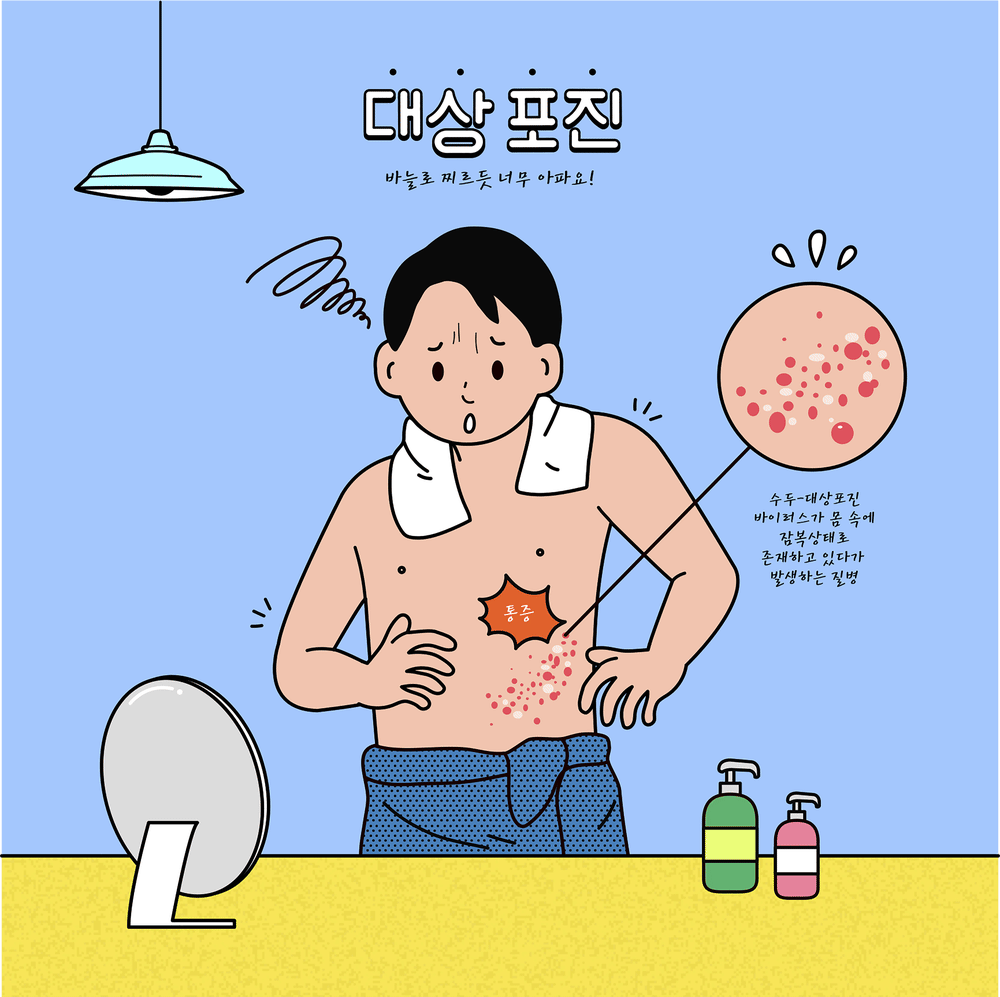 대상포진.gif